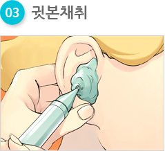 03 귓본채취